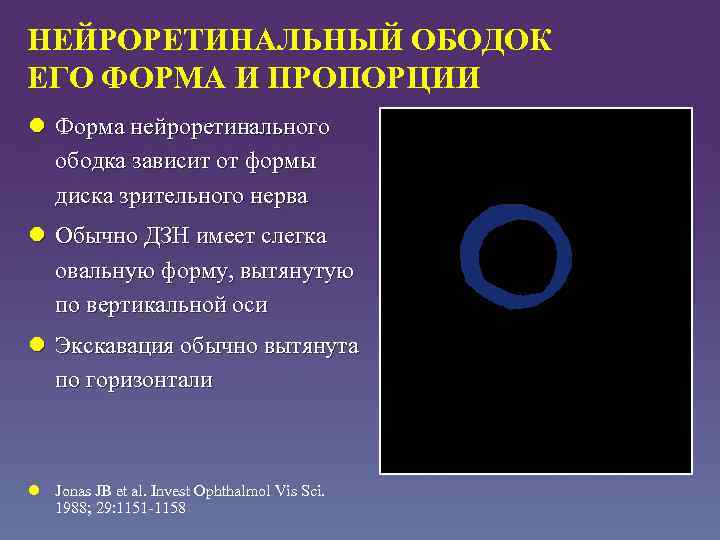НЕЙРОРЕТИНАЛЬНЫЙ ОБОДОК ЕГО ФОРМА И ПРОПОРЦИИ l Форма нейроретинального ободка зависит от формы диска