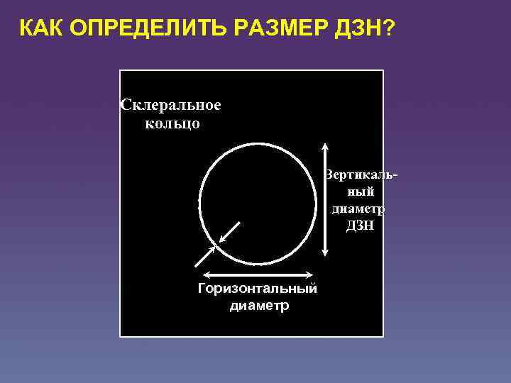 КАК ОПРЕДЕЛИТЬ РАЗМЕР ДЗН? Склеральное кольцо Вертикальный диаметр ДЗН Горизонтальный диаметр 