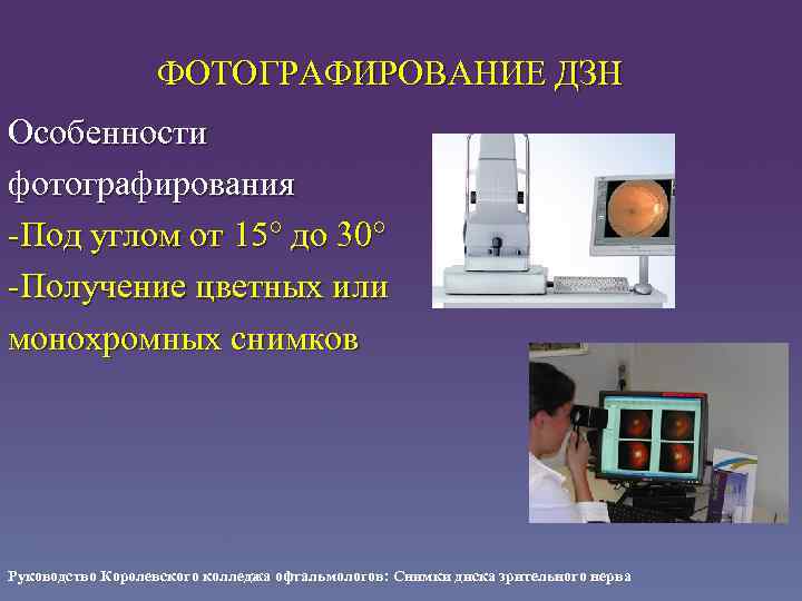 ФОТОГРАФИРОВАНИЕ ДЗН Особенности фотографирования -Под углом от 15 до 30 -Получение цветных или монохромных