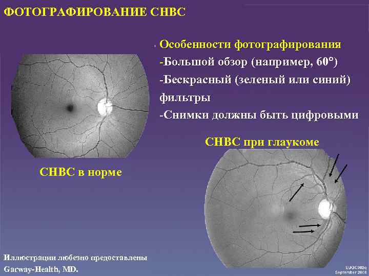 ФОТОГРАФИРОВАНИЕ СНВС • Особенности фотографирования -Большой обзор (например, 60 ) -Бескрасный (зеленый или синий)