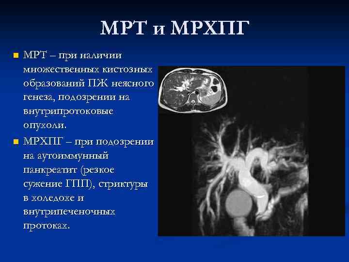 МРТ и МРХПГ n n МРТ – при наличии множественных кистозных образований ПЖ неясного