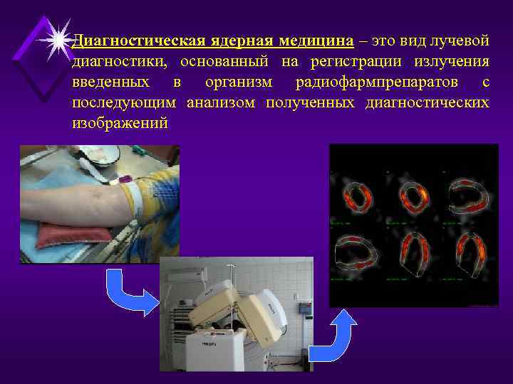 Диагностическая ядерная медицина – это вид лучевой диагностики, основанный на регистрации излучения введенных в
