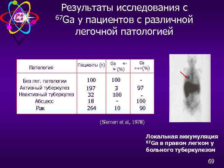 Результаты исследования с 67 Ga у пациентов с различной легочной патологией Патология Без лег.