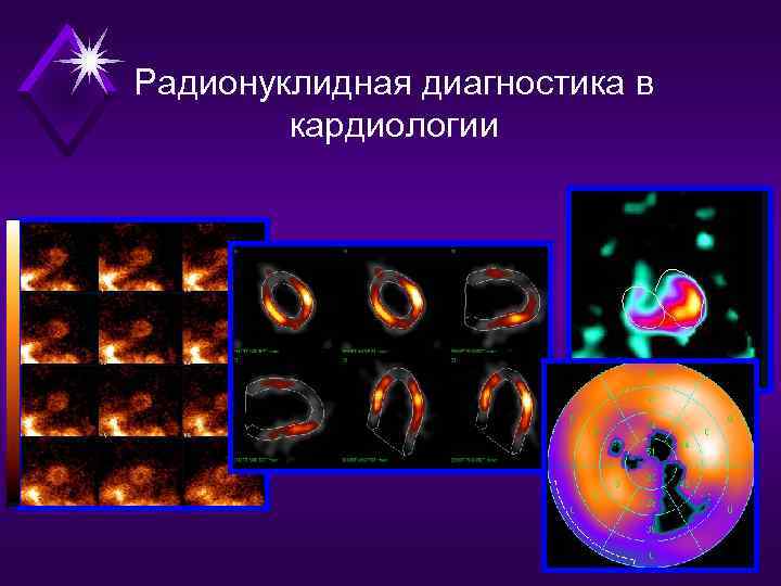 Радионуклидная диагностика в кардиологии 