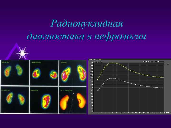Радионуклидная диагностика в нефрологии 
