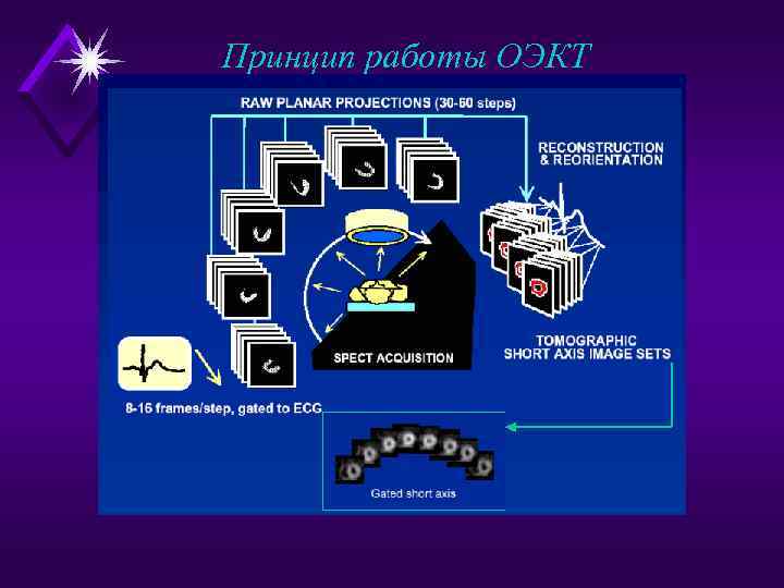 Принцип работы ОЭКТ 