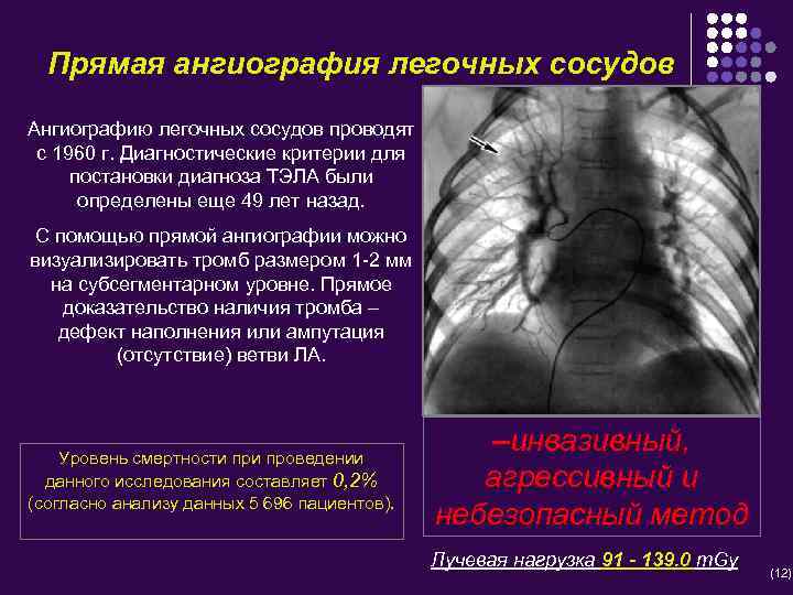 Прямая ангиография легочных сосудов Ангиографию легочных сосудов проводят с 1960 г. Диагностические критерии для