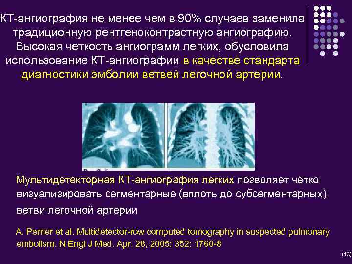 КТ-ангиография не менее чем в 90% случаев заменила традиционную рентгеноконтрастную ангиографию. Высокая четкость ангиограмм