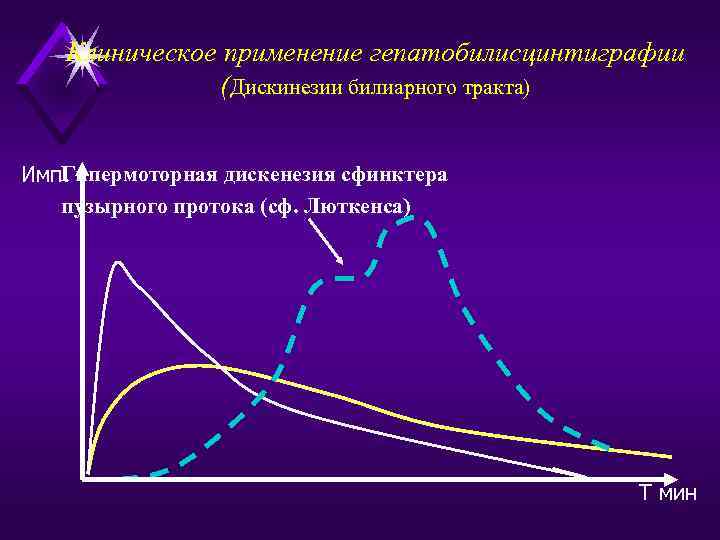 Клиническое применение гепатобилисцинтиграфии (Дискинезии билиарного тракта) Гипермоторная дискенезия сфинктера Имп. пузырного протока (сф. Люткенса)