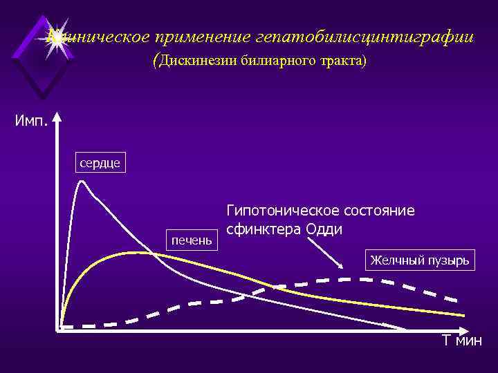 Клиническое применение гепатобилисцинтиграфии (Дискинезии билиарного тракта) Имп. сердце печень Гипотоническое состояние сфинктера Одди Желчный