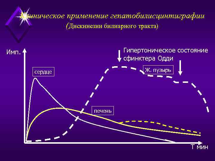 Клиническое применение гепатобилисцинтиграфии (Дискинезии билиарного тракта) Гипертоническое состояние сфинктера Одди Имп. Ж. пузырь сердце