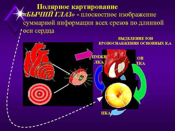Полярное картирование «БЫЧИЙ ГЛАЗ» - плоскостное изображение суммарной информации всех срезов по длинной оси