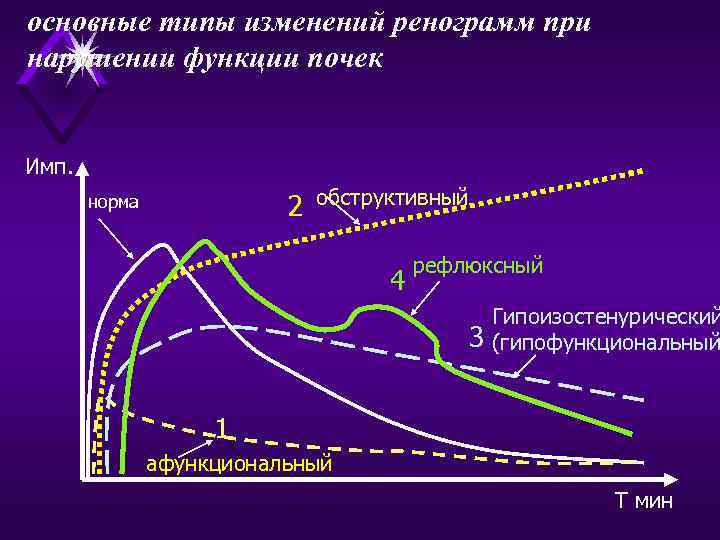 основные типы изменений ренограмм при нарушении функции почек Имп. 2 норма обструктивный 4 рефлюксный