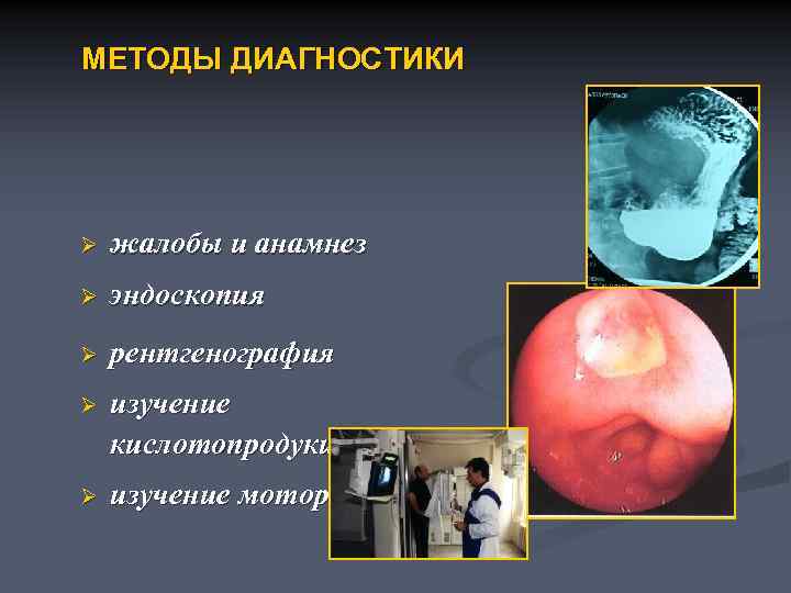МЕТОДЫ ДИАГНОСТИКИ Ø жалобы и анамнез Ø эндоскопия Ø рентгенография Ø изучение кислотопродукции Ø