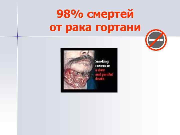 98% смертей от рака гортани 