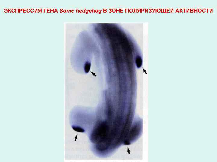 ЭКСПРЕССИЯ ГЕНА Sonic hedgehog В ЗОНЕ ПОЛЯРИЗУЮЩЕЙ АКТИВНОСТИ 