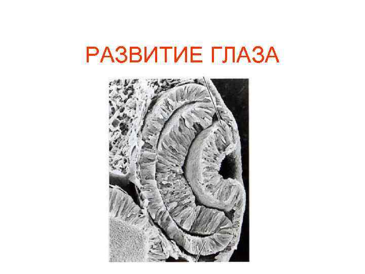 РАЗВИТИЕ ГЛАЗА 