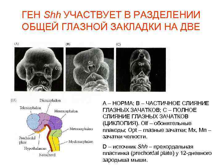 ГЕН Shh УЧАСТВУЕТ В РАЗДЕЛЕНИИ ОБЩЕЙ ГЛАЗНОЙ ЗАКЛАДКИ НА ДВЕ А – НОРМА; В