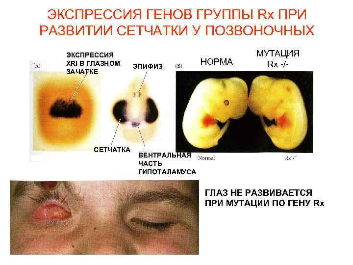 ЭКСПРЕССИЯ ГЕНОВ ГРУППЫ Rx ПРИ РАЗВИТИИ СЕТЧАТКИ У ПОЗВОНОЧНЫХ ЭКСПРЕССИЯ XRl В ГЛАЗНОМ ЗАЧАТКЕ