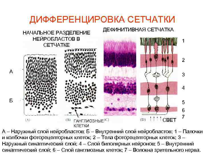 ДИФФЕРЕНЦИРОВКА СЕТЧАТКИ НАЧАЛЬНОЕ РАЗДЕЛЕНИЕ НЕЙРОБЛАСТОВ В СЕТЧАТКЕ ДЕФИНИТИВНАЯ СЕТЧАТКА 1 2 А 3 4