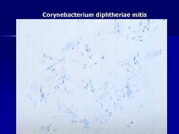 Corynebacterium diphtheriae mitis 