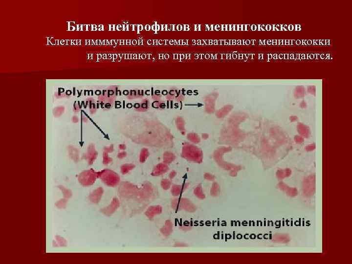 Менингококковая инфекция фото высыпаний