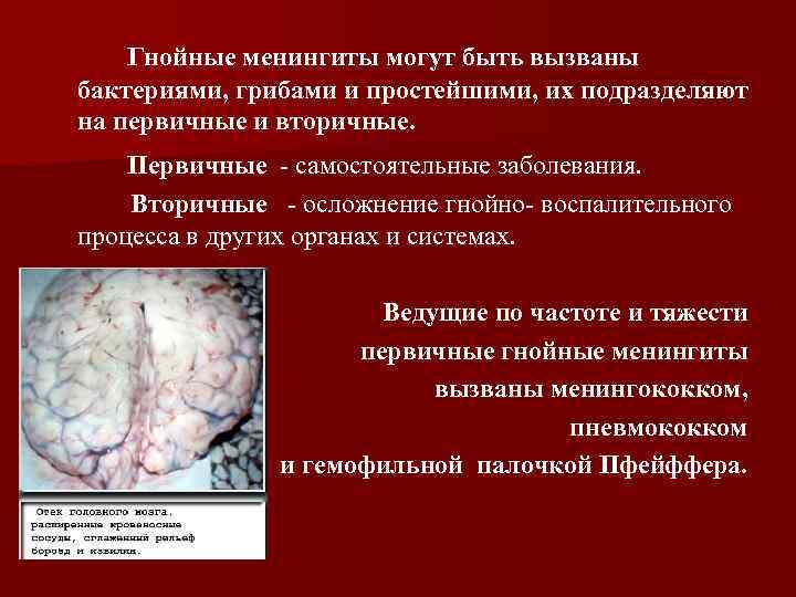 Гнойные менингиты могут быть вызваны бактериями, грибами и простейшими, их подразделяют на первичные и
