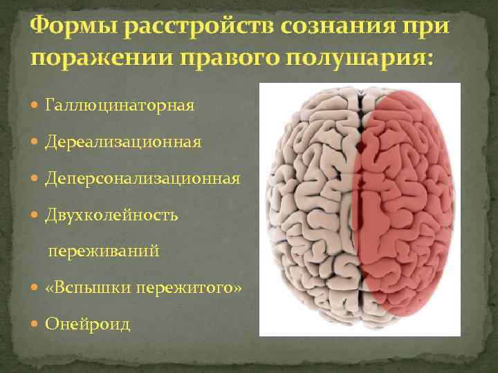 Формы расстройств сознания при поражении правого полушария: Галлюцинаторная Дереализационная Деперсонализационная Двухколейность переживаний «Вспышки пережитого»