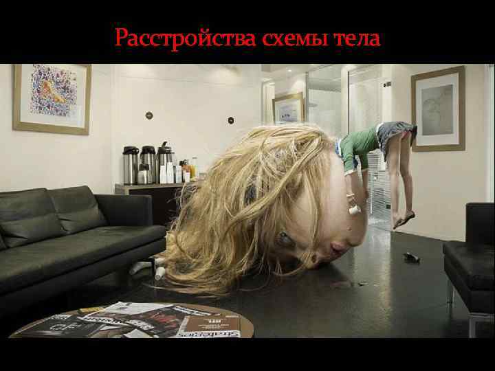 Расстройства схемы тела 