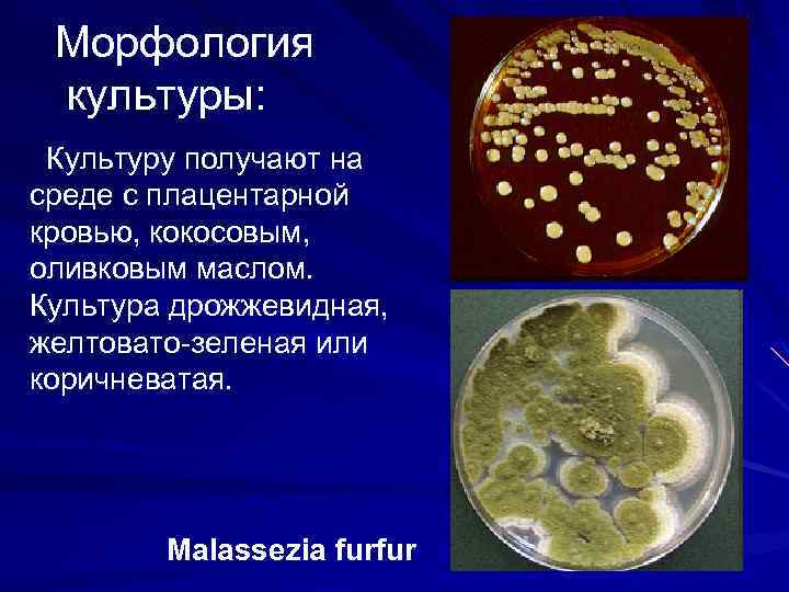 Возбудитель разноцветного лишая. Malassezia FURFUR микробиология.