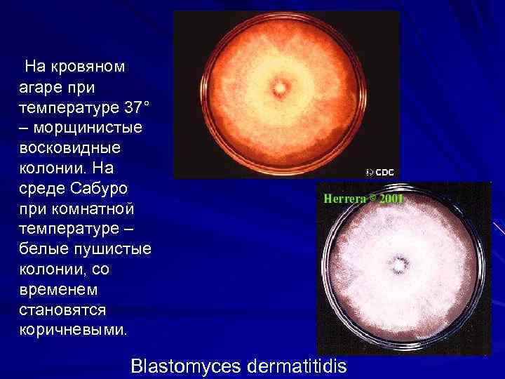 На кровяном агаре при температуре 37° – морщинистые восковидные колонии. На среде Сабуро при