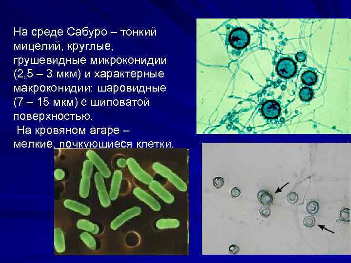 На среде Сабуро – тонкий мицелий, круглые, грушевидные микроконидии (2, 5 – 3 мкм)