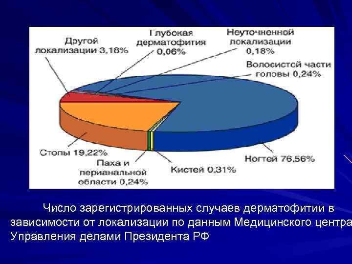 Число зарегистрированных случаев дерматофитии в зависимости от локализации по данным Медицинского центра Управления делами