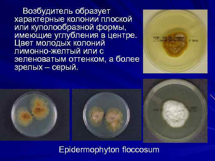 Возбудитель образует характерные колонии плоской или куполообразной формы, имеющие углубления в центре. Цвет молодых