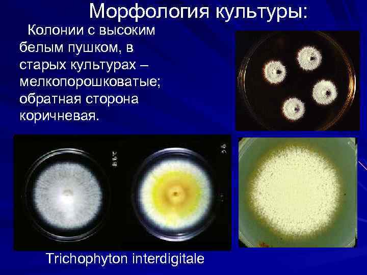 Морфология культуры: Колонии с высоким белым пушком, в старых культурах – мелкопорошковатые; обратная сторона