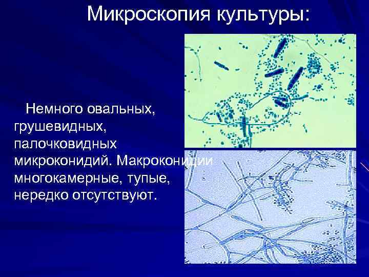 Микроскопия культуры: Немного овальных, грушевидных, палочковидных микроконидий. Макроконидии многокамерные, тупые, нередко отсутствуют. 
