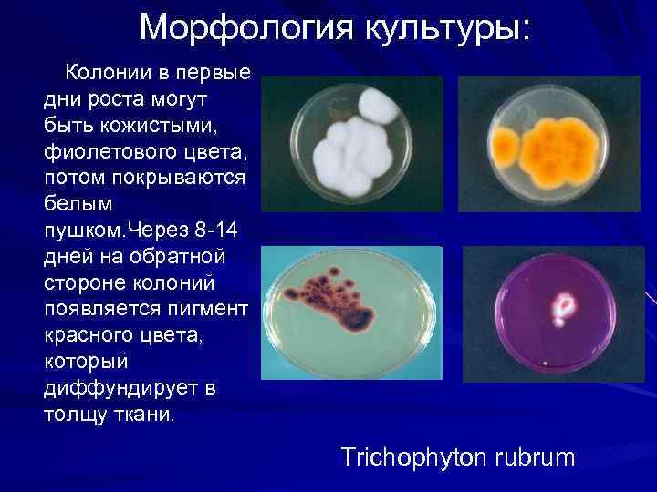 Морфология культуры: Колонии в первые дни роста могут быть кожистыми, фиолетового цвета, потом покрываются