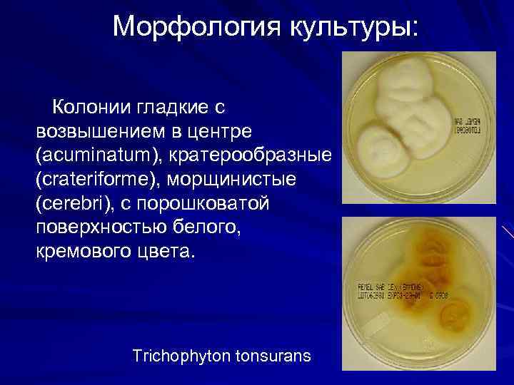 Морфология культуры