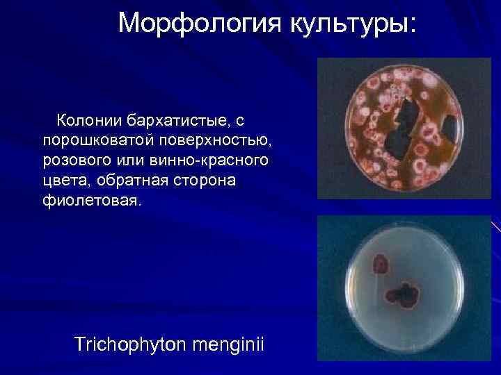 Морфология культуры: Колонии бархатистые, с порошковатой поверхностью, розового или винно-красного цвета, обратная сторона фиолетовая.
