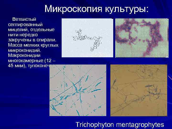 Обнаружены споры и мицелий. Септированный мицелий микроскопия. Нити мицелия микроскопия. Мицелий микроскопия. Trichophyton микроскопия.