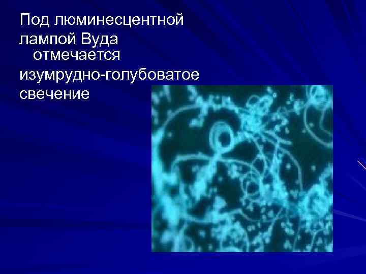 Под люминесцентной лампой Вуда отмечается изумрудно-голубоватое свечение 