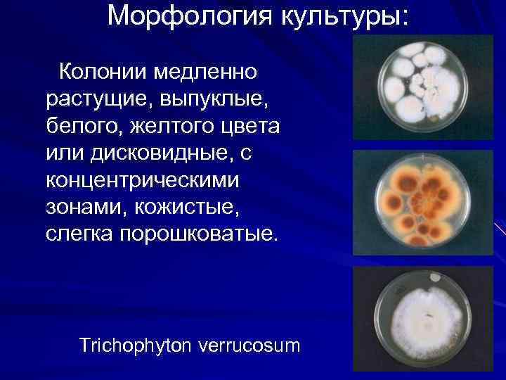 Морфология культуры: Колонии медленно растущие, выпуклые, белого, желтого цвета или дисковидные, с концентрическими зонами,