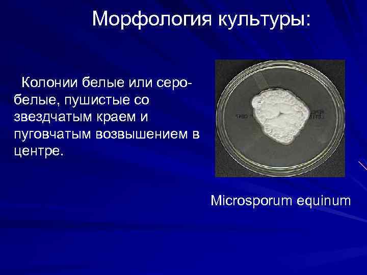 Морфология культуры: Колонии белые или серобелые, пушистые со звездчатым краем и пуговчатым возвышением в