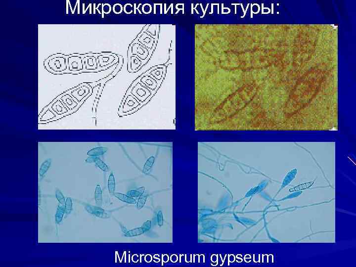 Микроскопия культуры: Microsporum gypseum 