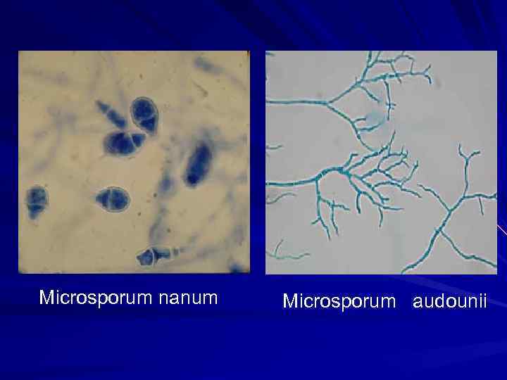 Microsporum nanum Microsporum audounii 