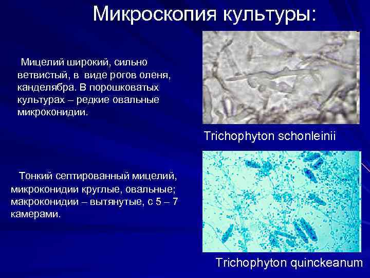 Микроскопия культуры: Мицелий широкий, сильно ветвистый, в виде рогов оленя, канделябра. В порошковатых культурах