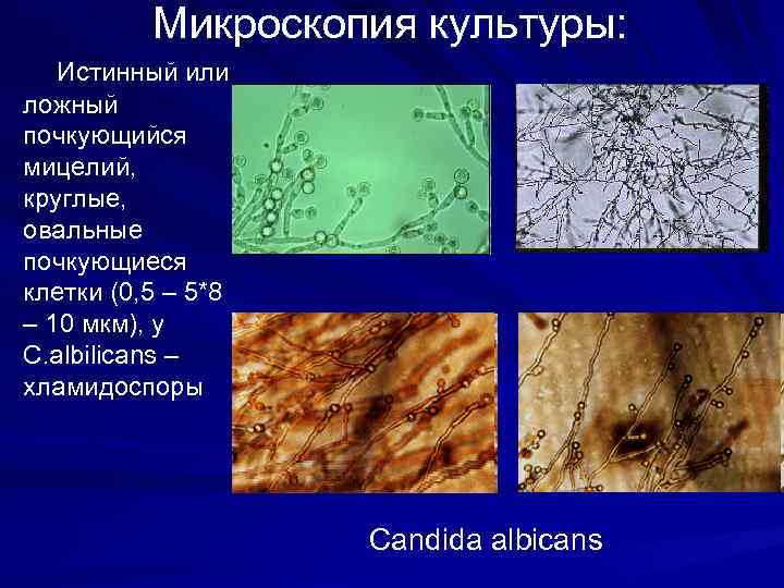 Тип поражения волос endothrix картинка