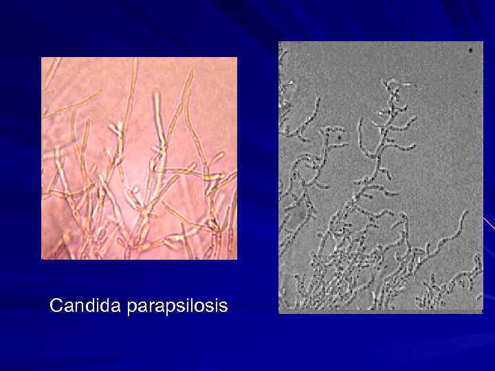 Кандида парапсилозис. Candida parapsilosis под микроскопом. Дерматофития под микроскопом. Кератомикоз под микроскопом. Кератомикозы дерматофитии кандидоз.