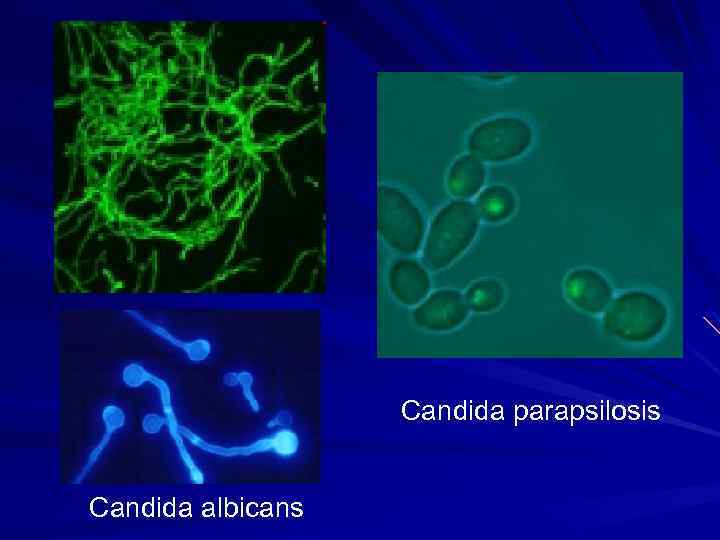 Candida parapsilosis Candida albicans 
