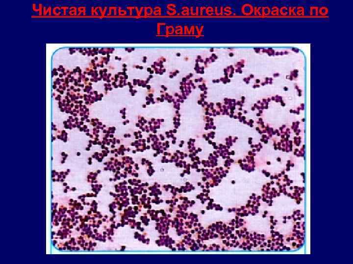 Чистая культура S. aureus. Окраска по Граму 